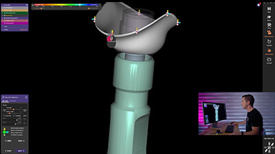 18. Posterior Implant- Screw Retained