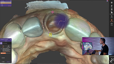 6. Anterior Crown