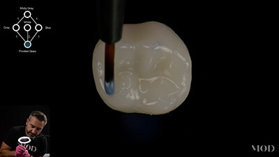 Posterior Crown Icon