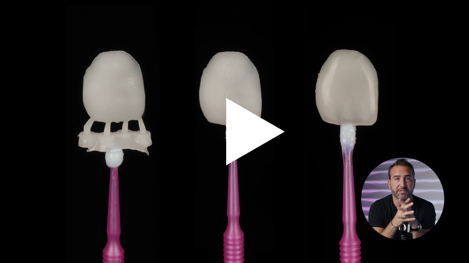 3D-Printed-Veneers-Course-Hero