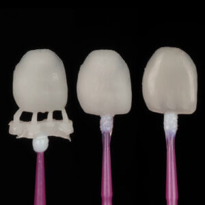 3D-Printed-Veneers-Product-Card