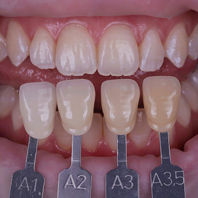 Dental Photography Course