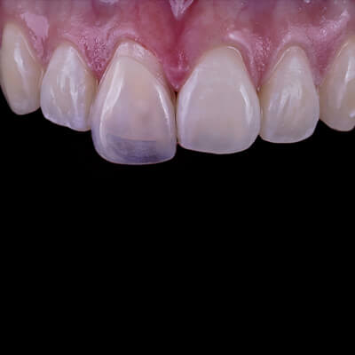 Dental Photography Course
