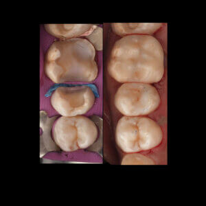 3D Printed Fillings CE Course Card