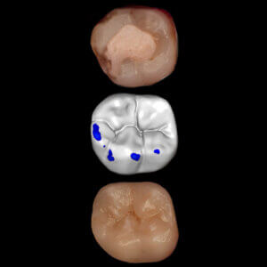 3D-Printed-Fillings-Course-Image