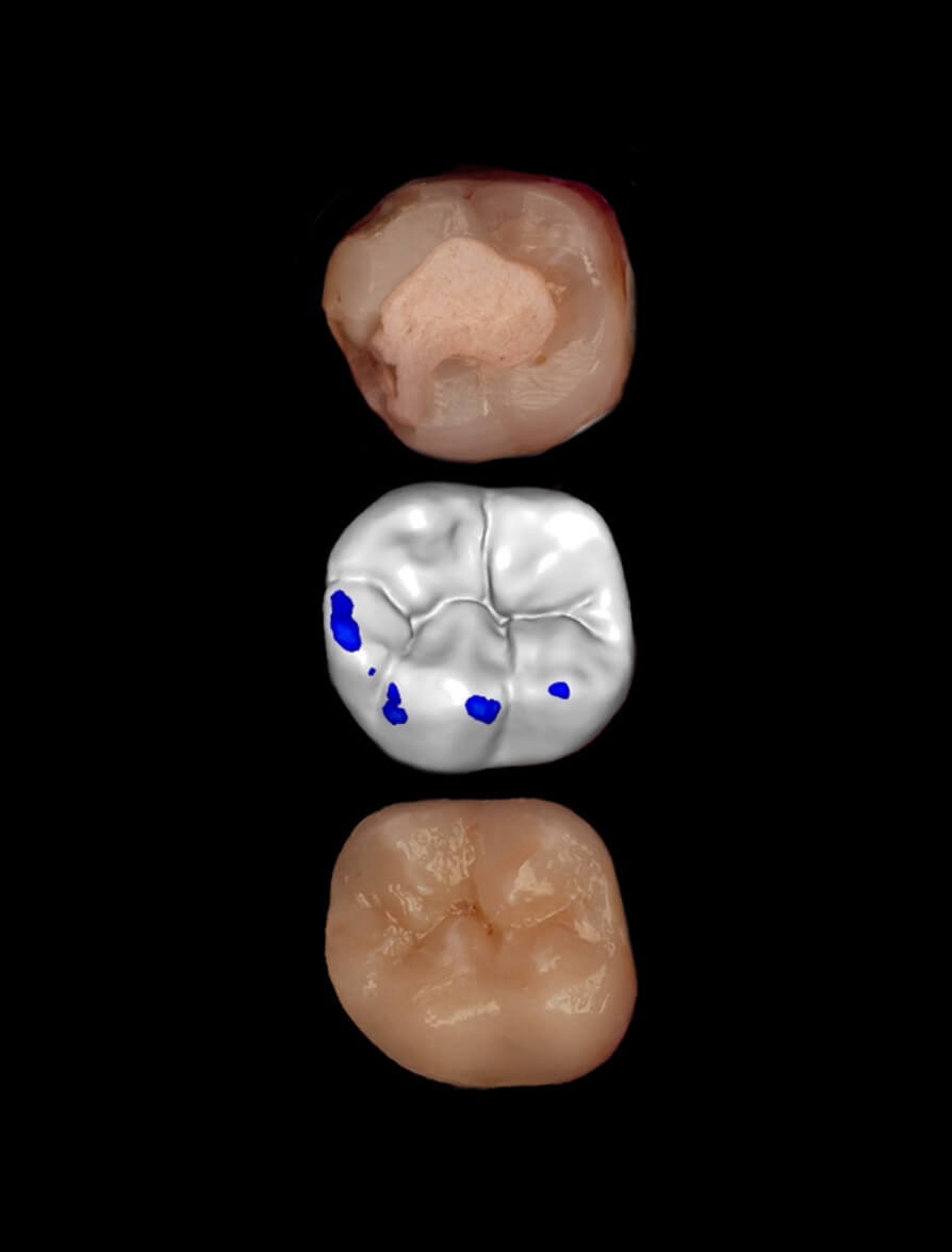 3D-Printed-Fillings-Course-Image