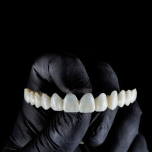 3D Printed Smile Design & Veneers