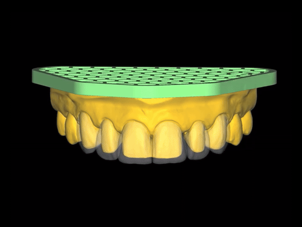 Tooth Design Animation