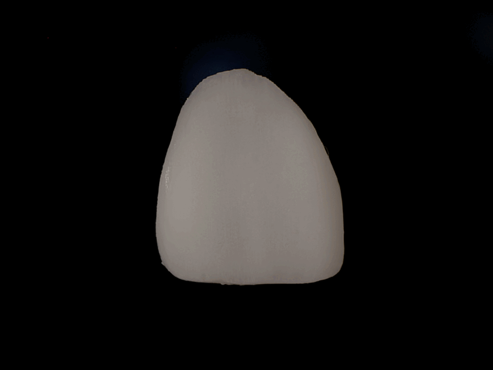 Tooth Finishing Animation