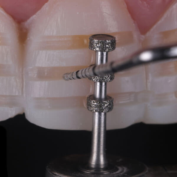 Tooth-Preparation-6
