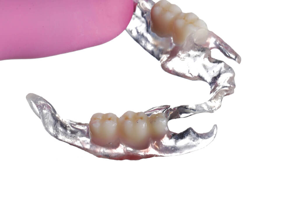 3D Printing in Dentistry Residency Day 4