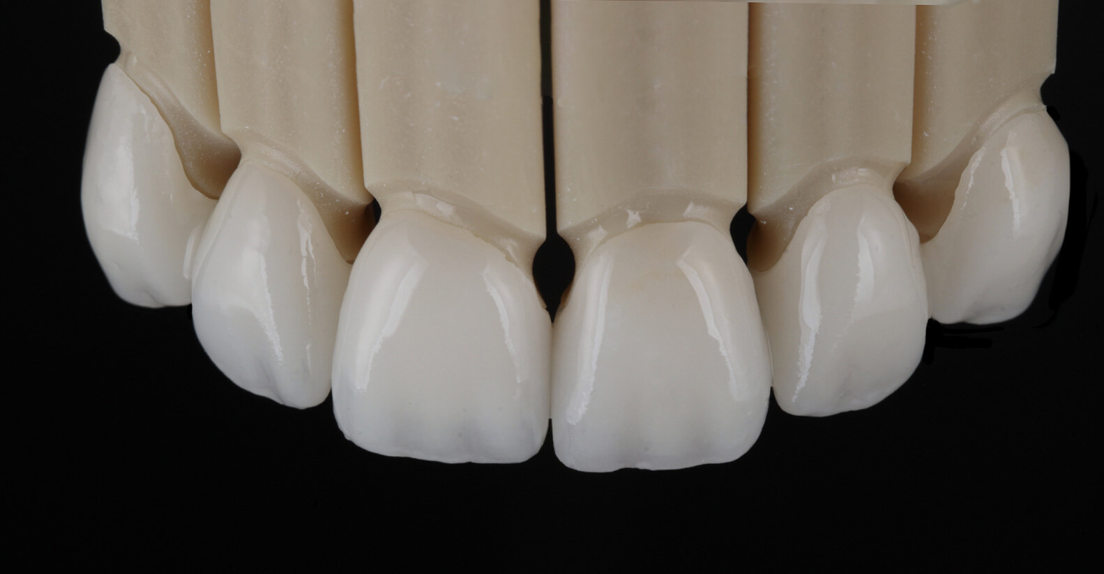 Full-Mouth-Slider-After