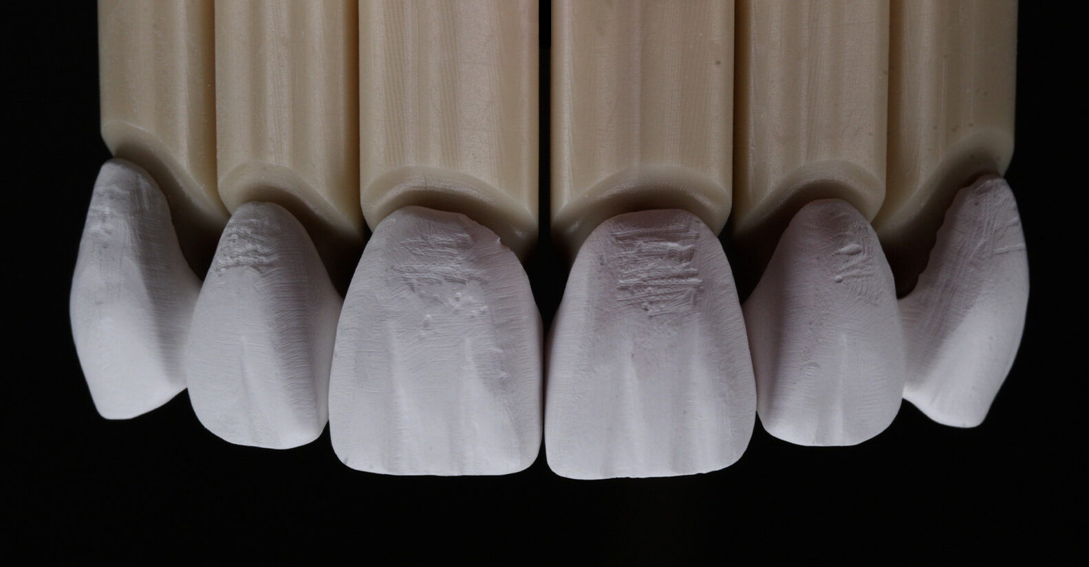 Full Mouth Restoration Before
