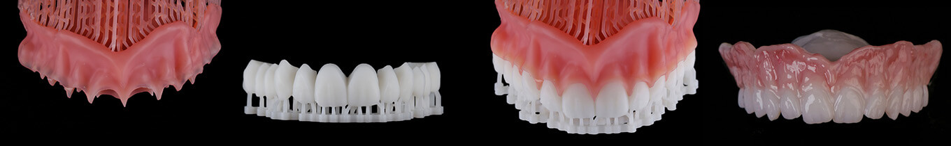 3D Printed Dentures CE Image