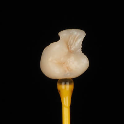 3D-Printed-Fillings-Residency-CE-4