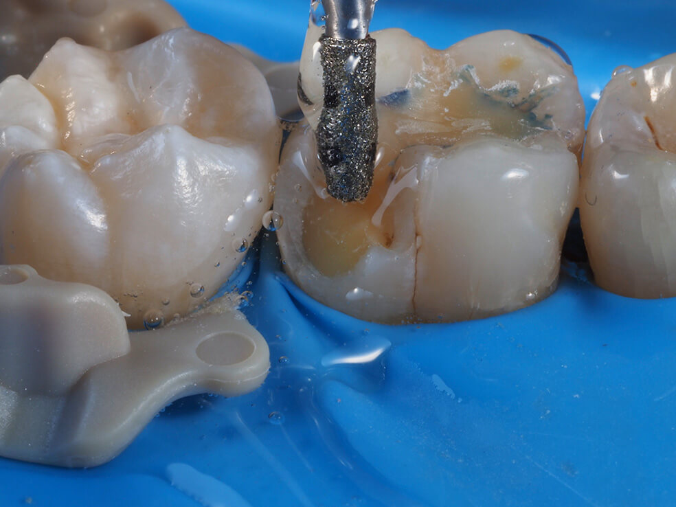 3D Printed Filling Residency Image 1
