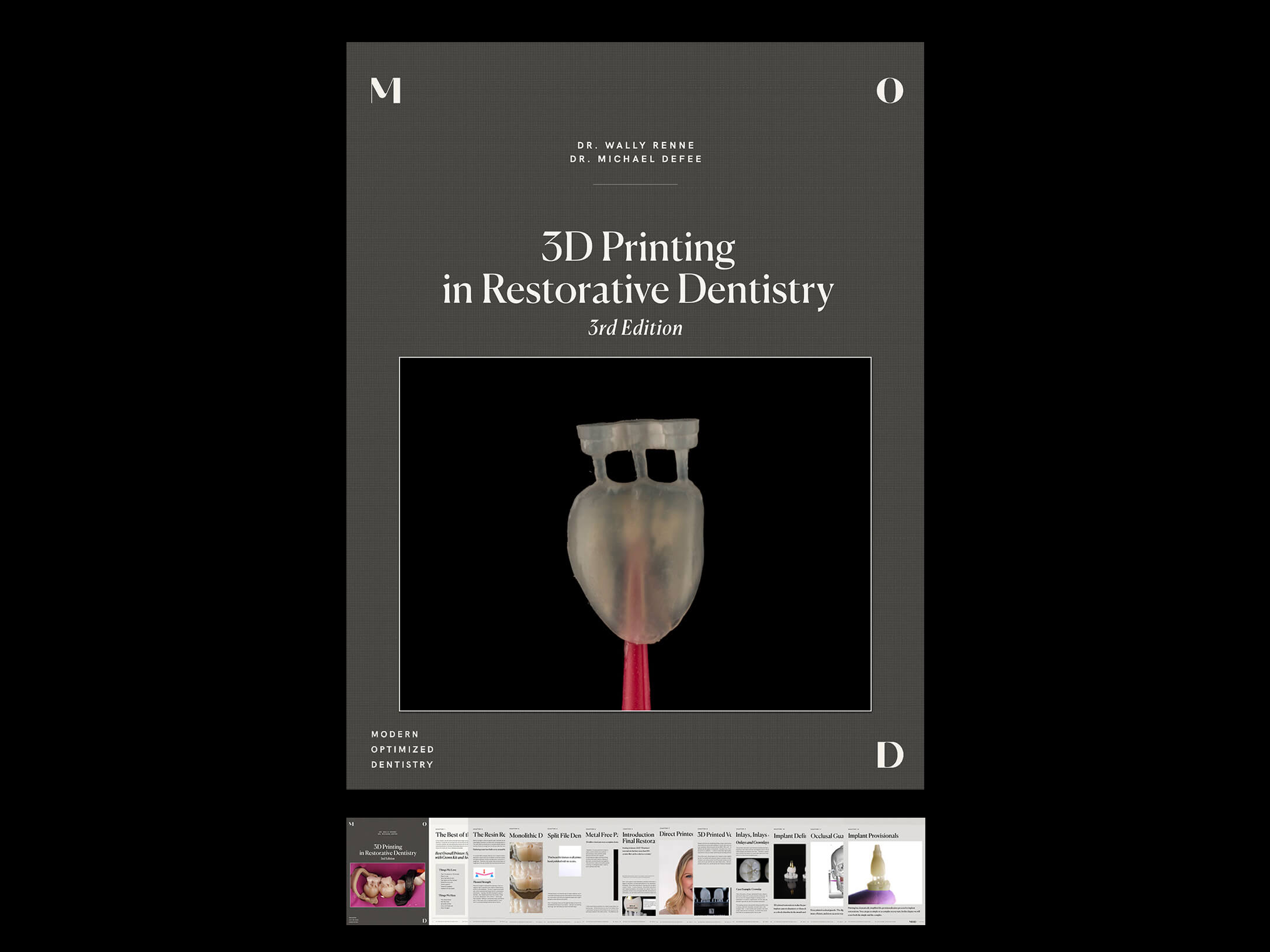 3D-Printing-in-Restorative-Dentistry-eBook-Image