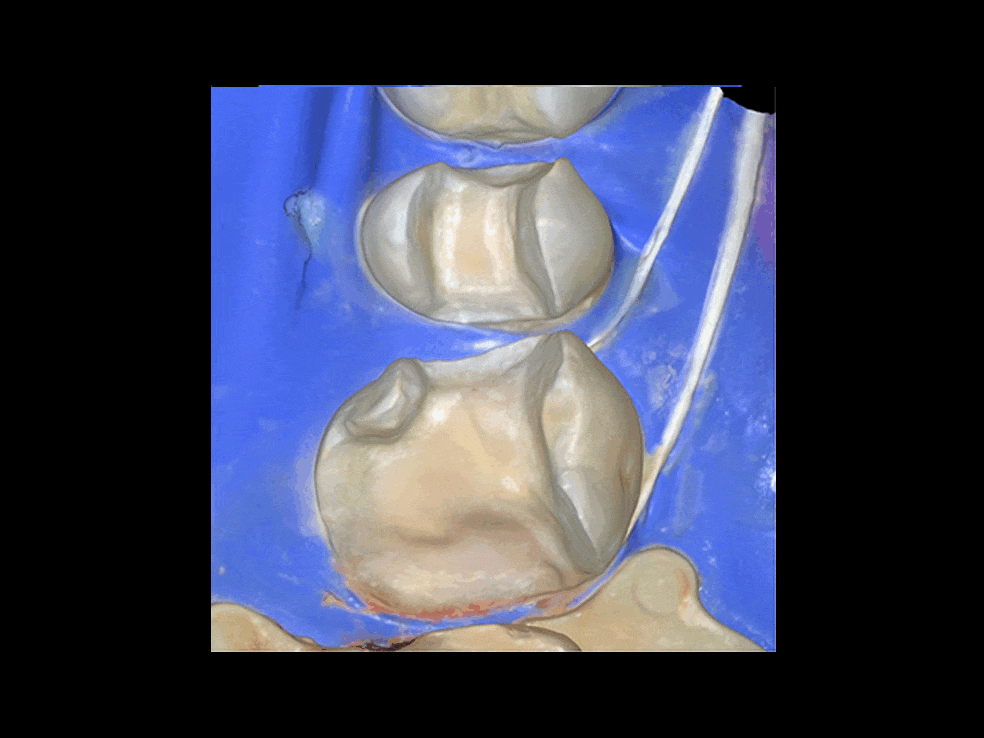 Day 4 Course Image