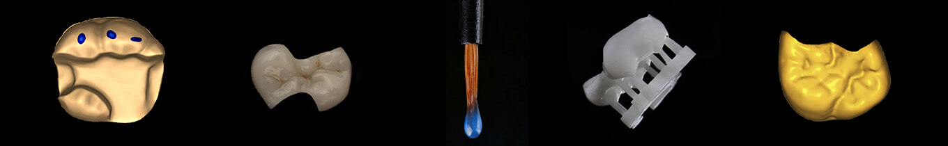 Fillings Inlays Onlays Dental CE