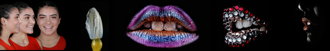 Photography-Dental-CE