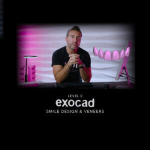 exocad-level-2-smile-design-veneers