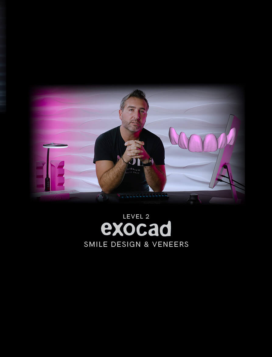 exocad-level-2-smile-design-veneers