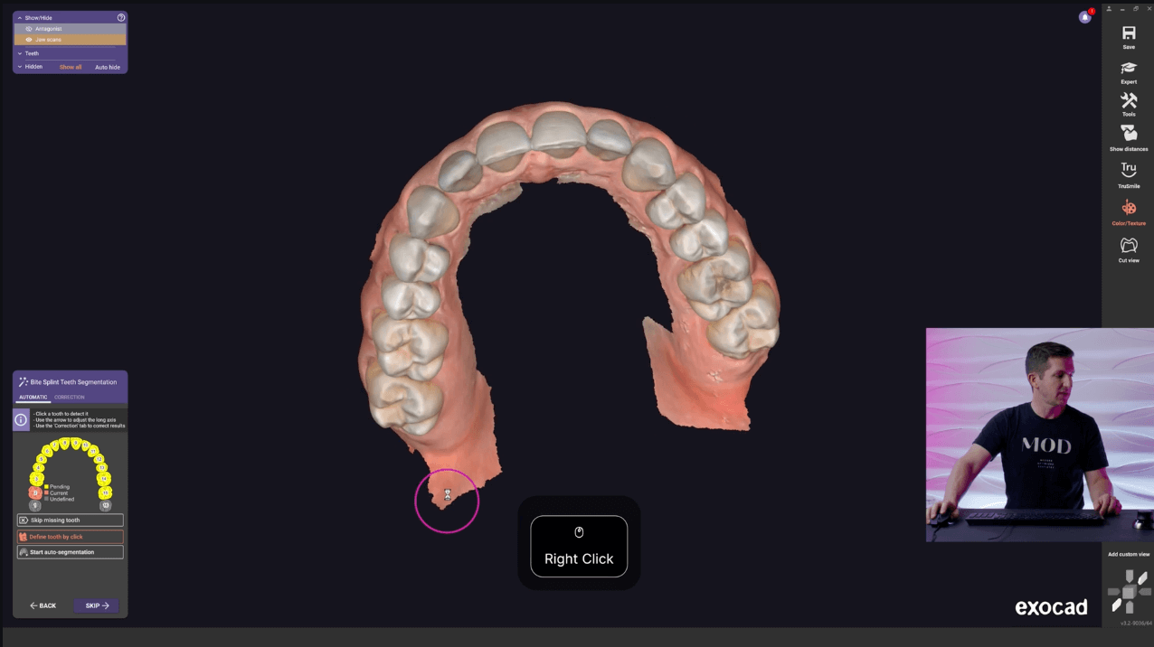 exocad level 10