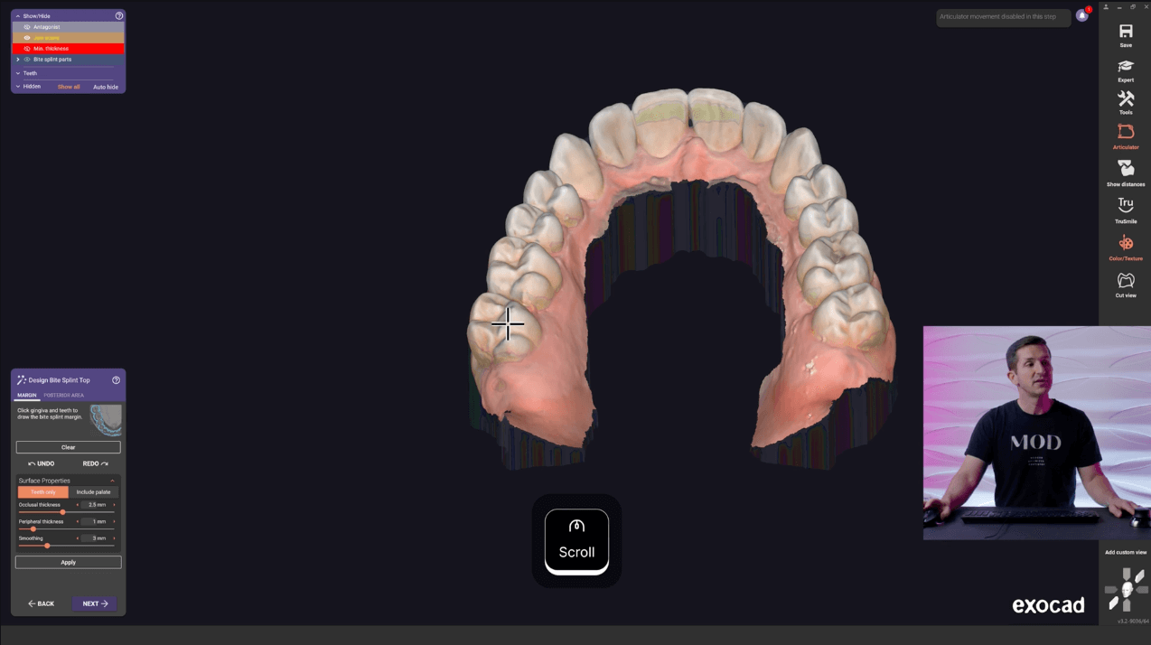 exocad level 11