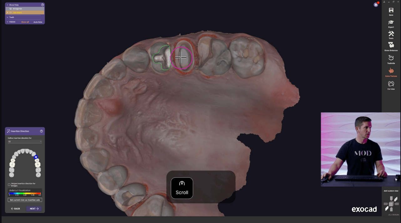 exocad lesson 9