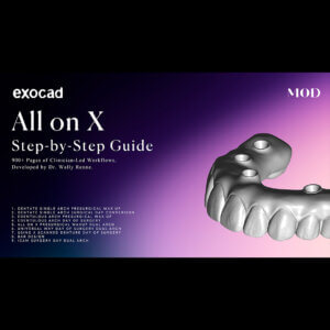 exocad all on x step by step guide