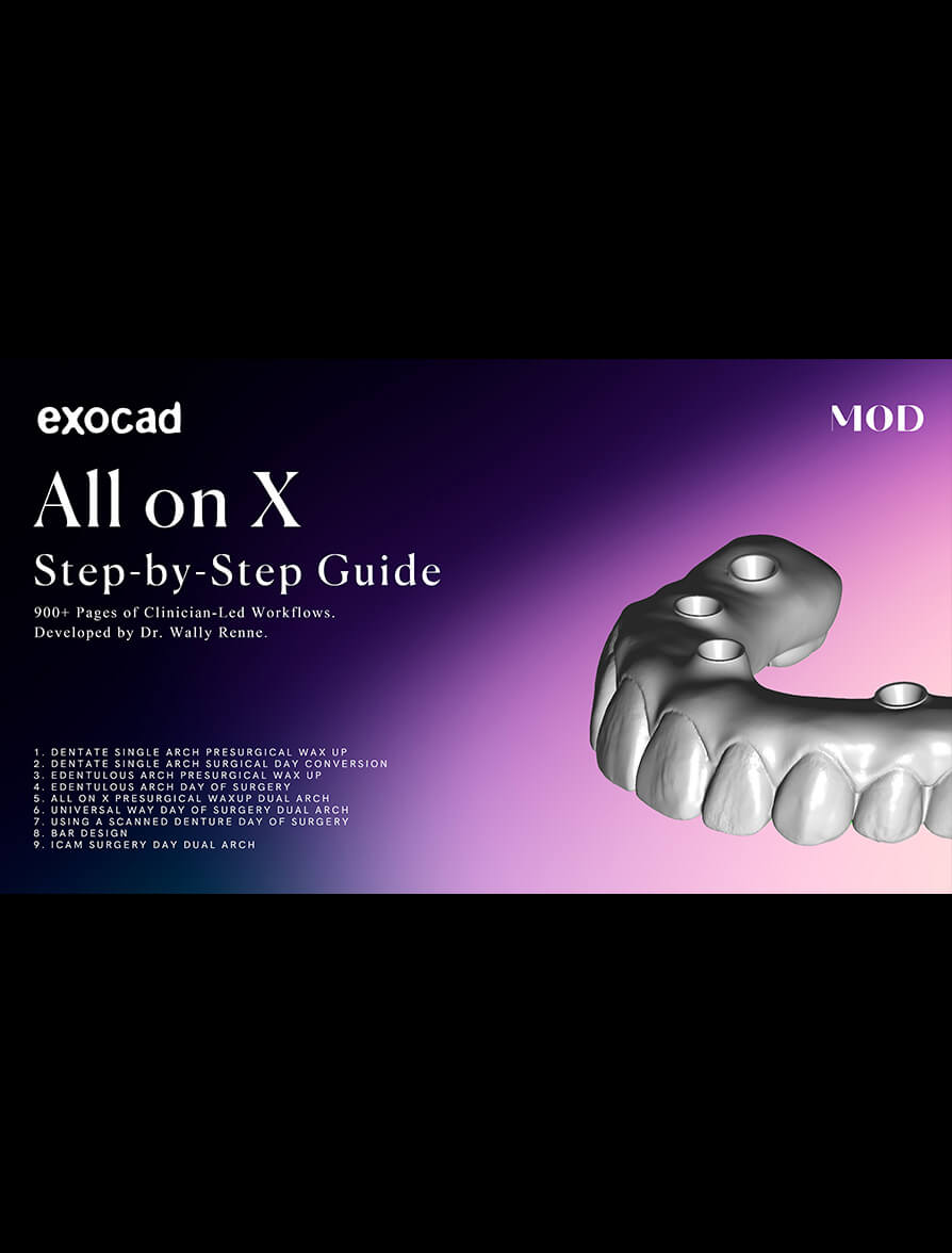 exocad all on x step by step guide