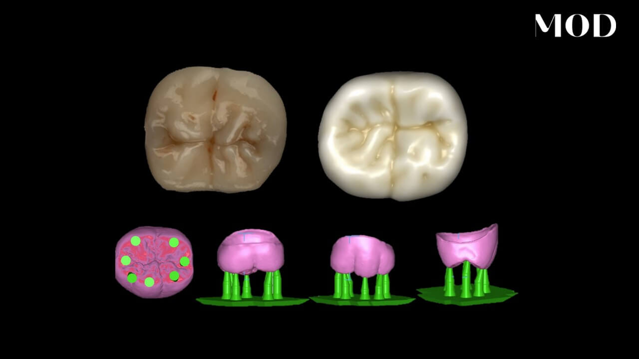 Nesting Crowns
