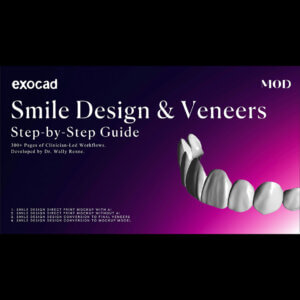 exocad Smile Design Step-by-Step Guide