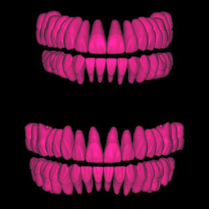 MOD exocad Tooth Libraries