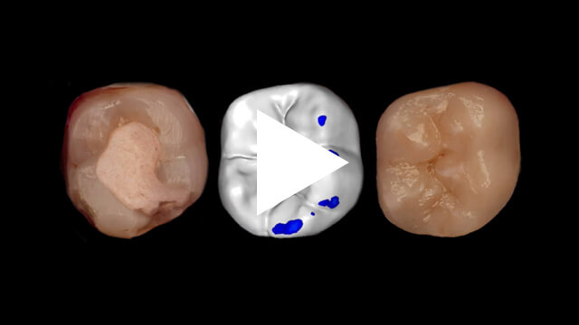 3D-Printed-Fillings-Pro-Online-Course