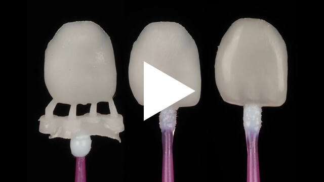 3D-Printed-Veneers-Online-Course-Pro