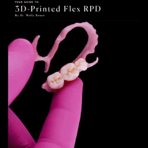 3D Printed Flex RPD Guide