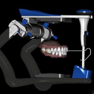 Ultra Conservative Full Mouth Restorations of the Worn Dentition