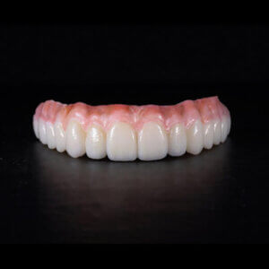 All on X Foundations